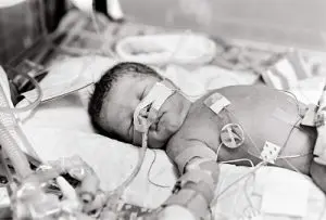 Child with Birth Injury