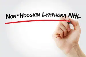 Non-Hodgkin Lymphoma Diagnosis