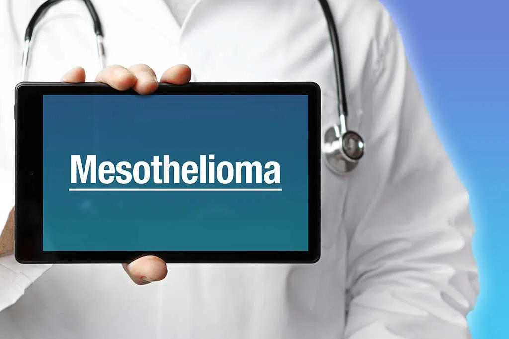Photo of Mesothelioma Sign with Doctor